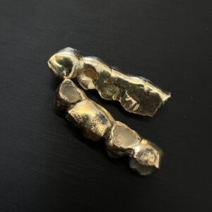 高松市で金歯・歯科用貴金属を高価買取。金高騰につき壊れた金製品の査定なら。